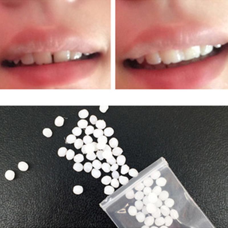 Teeth Gap Filler,Neyared Chipped Tooth Repair, Replacement Missing Teeth Gap Filler, Teeth Glue, Temporary Moldable Granules