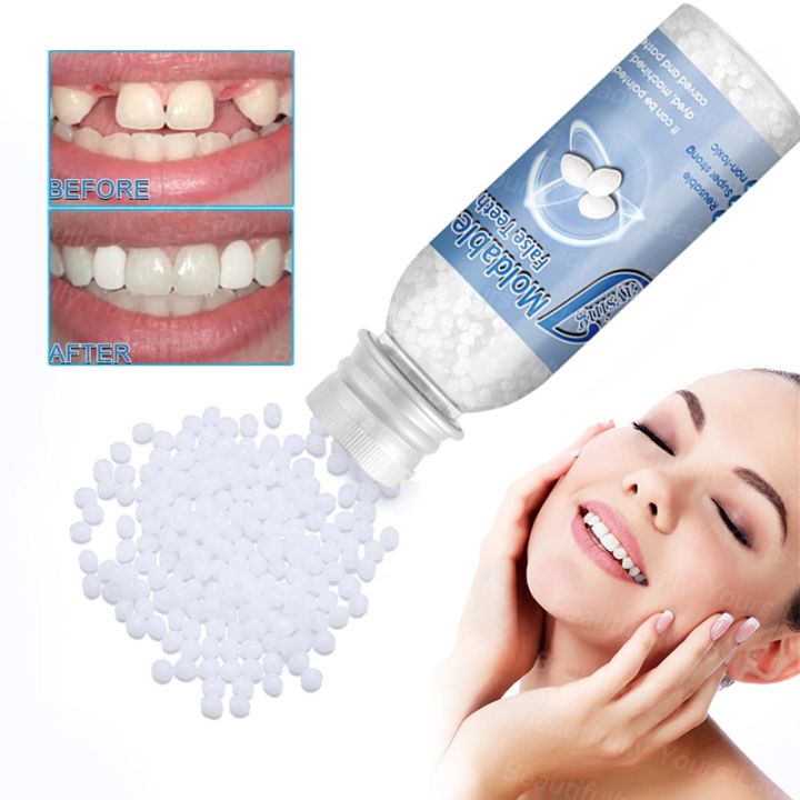 Teeth Gap Filler,Neyared Chipped Tooth Repair, Replacement Missing Teeth Gap Filler, Teeth Glue, Temporary Moldable Granules