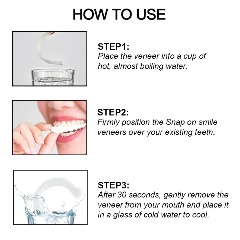 Snapon Smile/ veeners/ snap on smile veerners / veeners braces/Snapon Smile Teeth/ Snapon Smile Veeners/ Snapon Smile Artificial Teeth/ silicon braces/ Artificial teeth