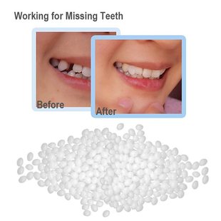 Teeth Gap Filler,Neyared Chipped Tooth Repair, Replacement Missing Teeth Gap Filler, Teeth Glue,  Temporary Moldable Granules