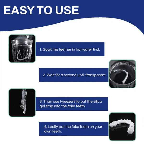 Snapon Smile/ veeners/ snap on smile veerners / veeners braces/Snapon Smile Teeth/ Snapon Smile Veeners/ Snapon Smile Artificial Teeth/ silicon braces/ Artificial teeth